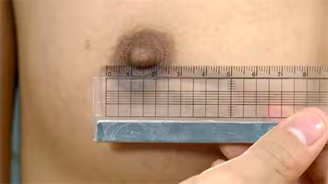 醫生檢查女模特身體