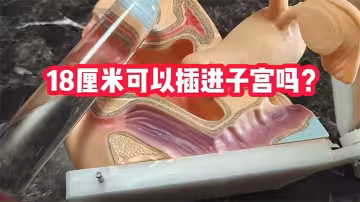 【獵奇】科普18cm可以插進子宮嗎？