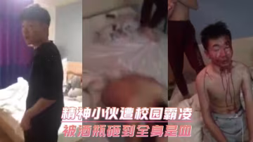 精神小伙遭校園霸凌 被酒瓶砸到全身是血..