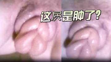 這屄是被玩腫了