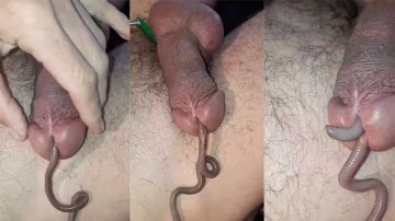 蚯蚓鑽馬眼惡趣味癖好