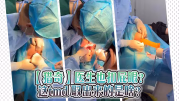 【獵奇】醫生也扣屁眼？ 這tmd 取出來的是啥？