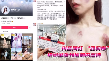 抖音网红雅典娜被闺蜜骗到缅甸的的虐待视频曝光