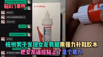 【粘B門事件】杭州男子發現女友劈腿 用強力補鞋膠水把女友逼給粘上了!是個狠人